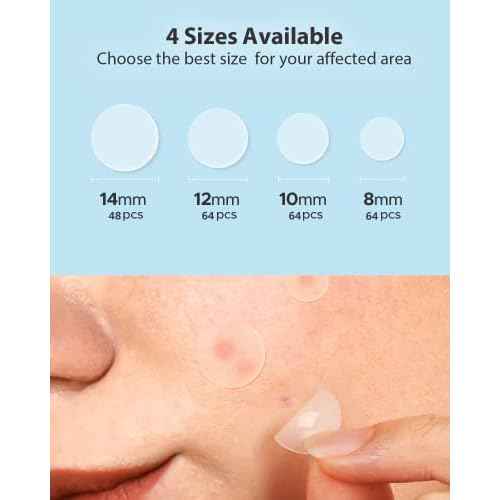 LitBear Acne Pimple Patches- Day and Night 4 Sizes 360 Dots Thin & Thick Hydrocolloid Patches with Witch Hazel, Tea Tree & Calendula Oil, Extra Adhesion Pimple Patches for Face Zit Patch Acne Dots