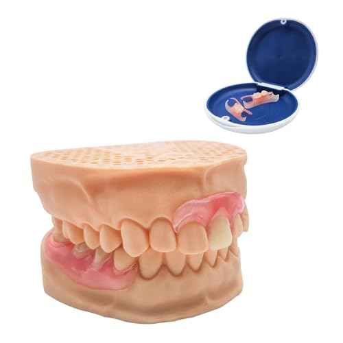 Custom Partial Dentures ? Personalized Removable Denture Set for Missing Teeth | 1?6 Tooth Replacement with Storage Case | Natural Look & Comfortable Fit (1 Tooth)