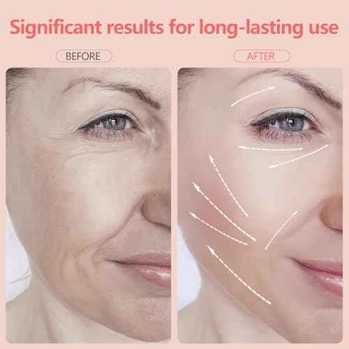 2025 New Face and Neck Massager Tool, 7 Colors LED Womens Skin Care Facial Massager for Skin Rejuvenation, Lifting, Toning, Glow Boost-White