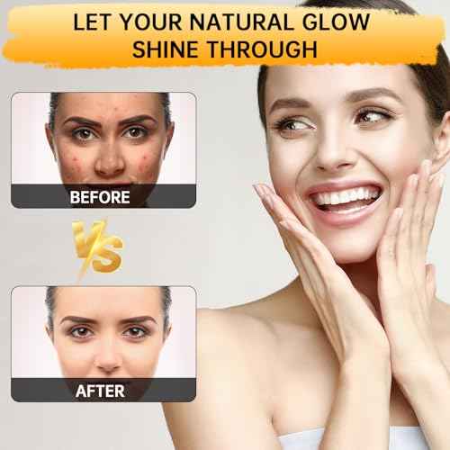 Kojic Acid Soap, Lemon Turmeric Soap Bar with Vitamin C for Dry Sensitive Skin, Turmeric Bar for Face, Body Hands 2 Bars
