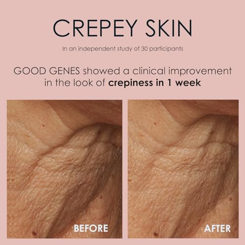 Sunday Riley Good Genes All-in-One Lactic Acid Treatment Face Serum