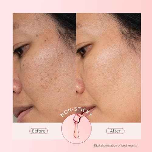10% Niacinamide + 5% Tranexamic Acid + 2% Alpha-Arbutin Dark Spot Serum with Ceramides Hyaluronic Acid Centella Asiatica - Korean Glass Skin Vegan Paraben Fragrance Cruelty Free 1 FL OZ/30mL