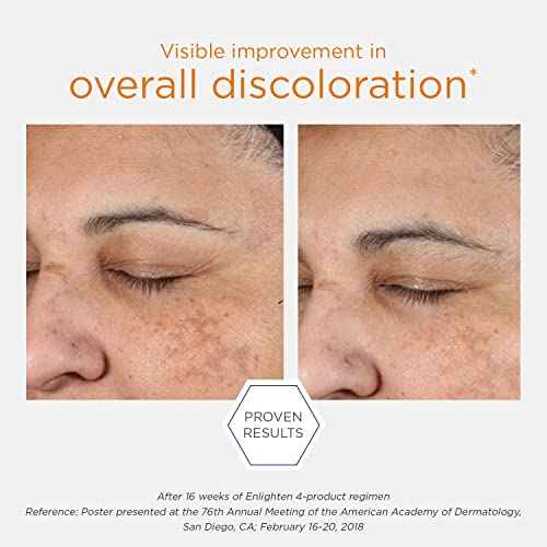 NEOSTRATA Pigment Controller Brightening Face Treatment with Retinol, Vitamin C. Oil-free, 1.7 fl oz
