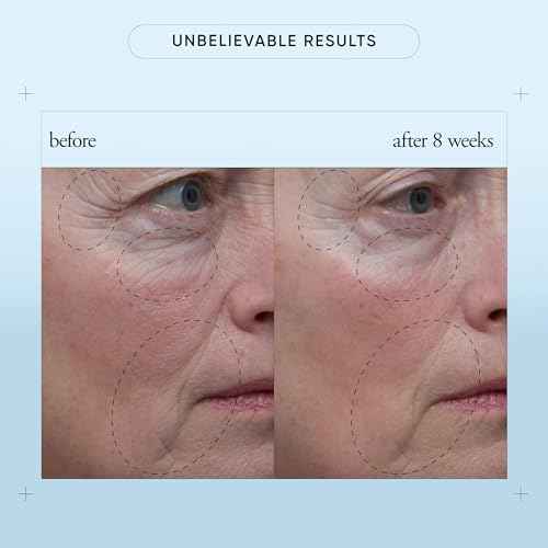 philosophy when hope is not enough facial firming serum - with vitamins C, E & hyaluronic acid - revitalizes dull complexion while reducing the look of fine lines and wrinkles - 1 fl oz