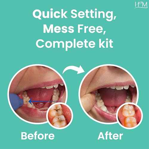 HM Zinc Oxide Eugenol Dental Cement Kit | Super Adhesive | Instant Tooth Repair, Cap, Crown & Bridge Filling | DIY, Self Curing, Sturdy & High Strength |Universal Shade| Emergency Dental Care | 1 Box