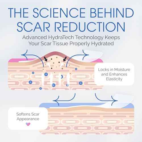 C Section Scar Silicone Strips for Surgical Scars, Tummy Tuck, and Postpartum Recovery - Tape for Scars - Reusable Silicone Scar Sheets - C Section Recovery Must Haves - Large 7-Inch Size, 8-Pack
