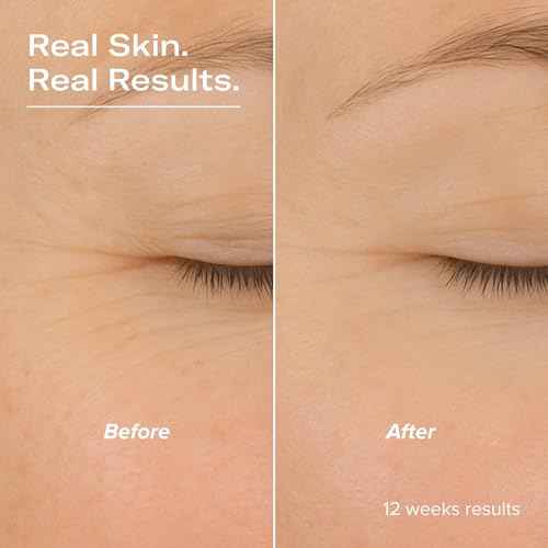 SMOOTH Retinol and Peptide Serum with Encapsulated Retinol, Bakuchiol, Matrixyl 3000, Melatonin, Vitamin E, Anti-Aging, Targets Fine Lines, Uneven Texture, Dullness, 1 fl oz