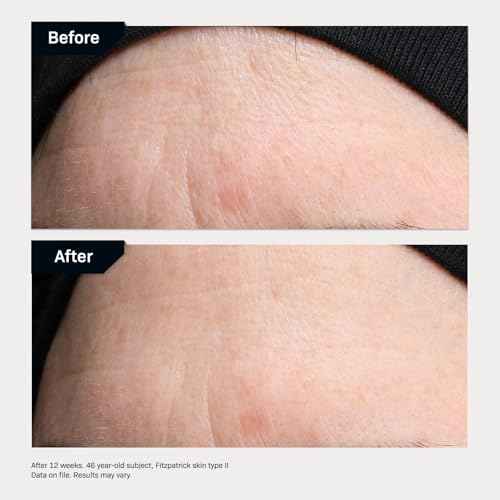 Revision Skincare Revox¢â Line Relaxer, Targeted Under Eye Serum with Hyaluronic Acid, Improves Fine Lines and Wrinkles
