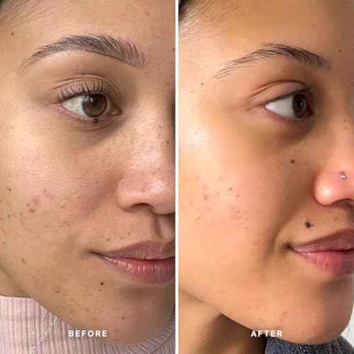 LIQUID GOLD EXFOLIATING TREATMENT WITH 5% GLYCOLIC ACID 100ml