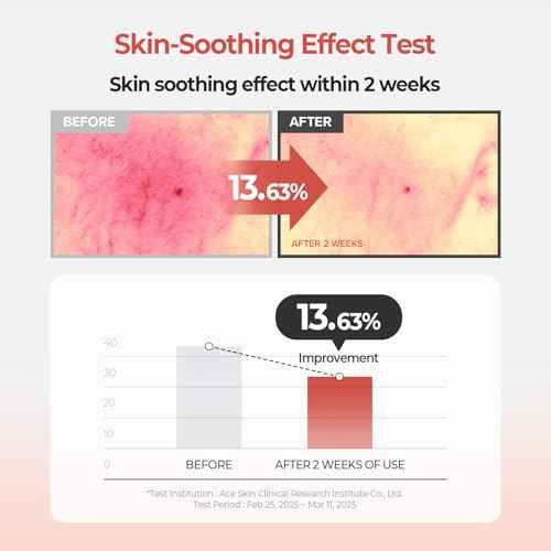 SKINFOOD Peach Cotton Zinc PCA Toner Pads, Korean Skincare for Dual Functional Hydrating,Soothing & Matte, Velvety Finish, Stocking Stuffers, Sebum Control for Sensitive, Oily, 5.64 oz (70 Pads)