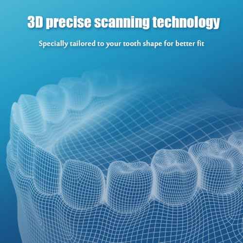 Custom Clear Retainers for Teeth, Retainer Kit for Teeth, Comfort Fit Dental Retainer for Adults & Kids, Prevent Teeth Shifting (Upper & Lower, Count, 2)