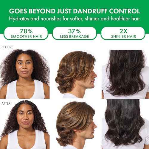 Dercos Dandruff Shampoo, Antifungal Dry Scalp Treatment & Itchy Scalp Relief, Prescription Strength Selenium Sulfide Comparable to 2% Ketoconazole, For Mild to Severe Dandruff & Flaky Scalps