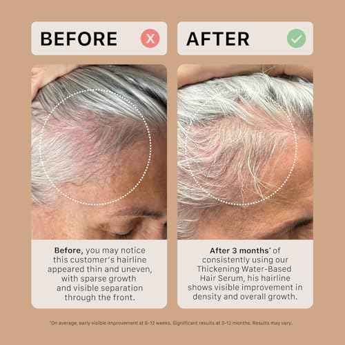 ACTIIV Thickening Hair Serum - Oil Based | Supports the Appearance of Thicker, Fuller-Looking Hair, for Textured & Curly Hair, Deeply Nourishes & Strengthens Roots, Non-Greasy, All Hair Types, 1.8 oz