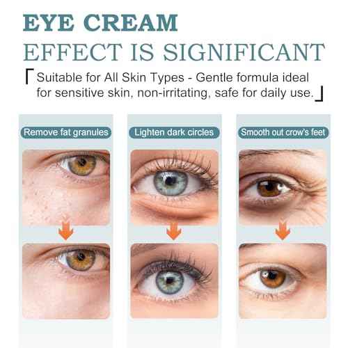 Temporary Tightener Eye Cream-Instantly Reduces Under-Eye Bags, Dark Circles&Wrinkles, Anti-Aging with Retinol&Hyaluronic Acid,Under Eye Care Creams Suit Women Men Firm Smooth firming Non-Greasy-IIII
