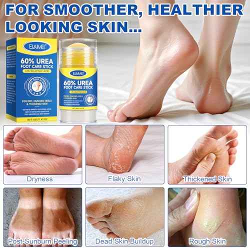 60% Urea Cream Stick with Salicylic Acid 2%, Severe Cracked Heel Repair Restoring Balm, Urea Hydrating Foot Cream, Foot Lotion Heel Stick Repairs and Hydrates Dry and Cracked Feet and Hand- 2 Packs