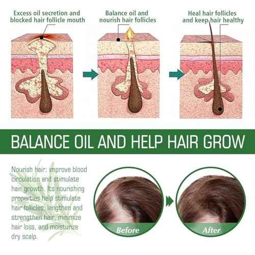 Aceite de Romero para Crecimiento y Tratamiento Capilar, Gotero para Estimular el Crecimiento del Cabello y Prevenir la Ca?da, 60ML/2.2 Fl Oz (2 Unidades)