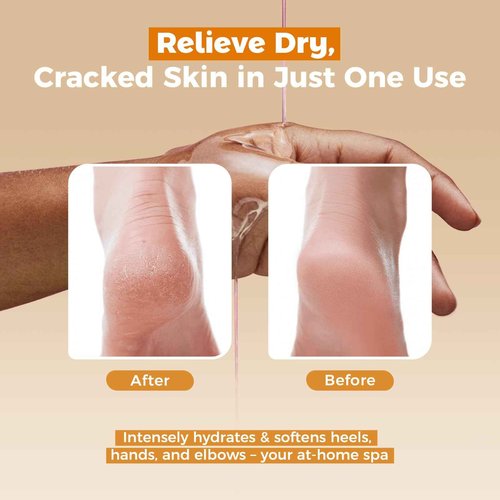 GIRLEARLE Paraffin Wax Refills 10 Packs Unscented for Paraffin Wax Bath Machine - for Dry Cracked Skin on Hands, Feet, Elbows - Moisturizing Hydration to Relieve Stiff Muscles & Joints