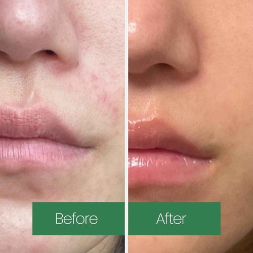 LAPALETTE Calming Green Turnover Toner | Green Tea | Hydrating & Moisturizing | Gentle Peeling with Natural Aha, Bha & PHA Ingredients | Korean Skincare 6.75fl.oz