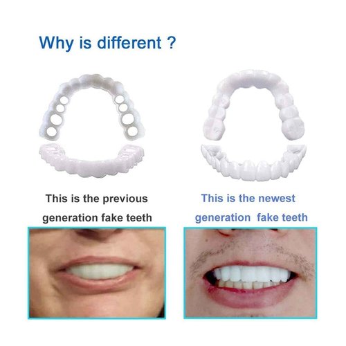 2 Pairs, Nature and Comfortable Top and Bottom, Regain Confidence Smile for Men and Women (1)