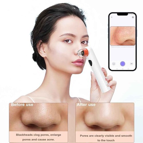 Blackhead Remover Vacuum,Blackhead Remover Tool with HD Camera & USB Charging - Pimple Extractor Vacuum,3 Stops & 4 Suction Heads Pore Extractor (White) (White)