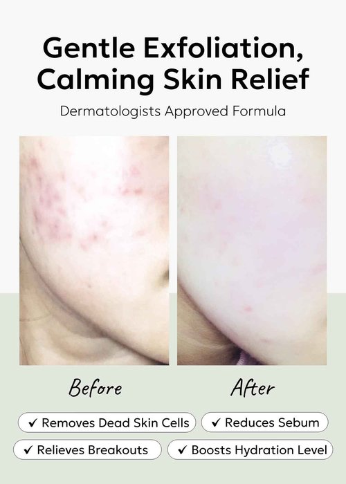 celimax Ji.Woo.Gae Heartleaf BHA Peeling Pad(60 pads) + Noni Energy Ampoule 30ml Bundle