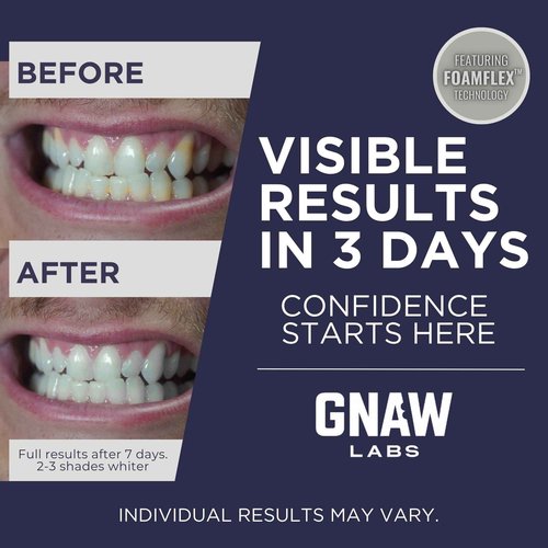 GNAW LABS Teeth Whitening Strips for Men – Mint Fresh | 14 Treatments | Enamel Safe Hydrogen Peroxide Formula with Mint | FoamFlex™ Technology | No Sensitivity, Professional Whitening Kit.