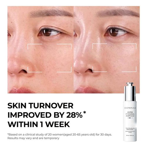 DOMINAS 10% Tranexamic Acid + 5% Mandelic Acid + 5% Niacinamide Brightening Serum, Powerful Dark Spot Corrector for Face, Fast Results in 2 Weeks, 1.01 fl oz
