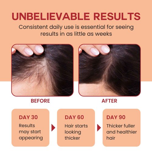 Lebanta Raw Batana Oil for Hair Growth - Cold Pressed Scalp Mask and Wonder Growth Oil Serum, thick and strong natural hair for men & women