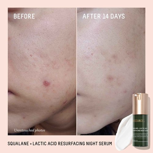 Biossance Rapid Radiance Set