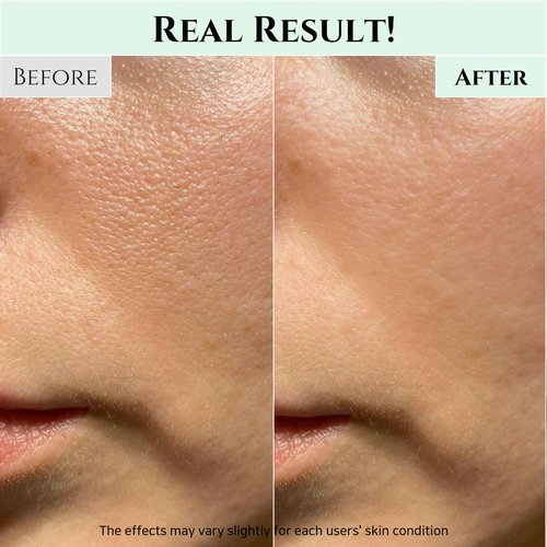 Beauty of Joseon Green Plum Refreshing Cleanser Gel with Radiance Cleansing Balm