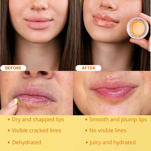 Original My Bee Balm Lip Balm - Peach Hydrating Balm Honey Pot for Dry, Chapped & Cracked Lips with Propolis, Honey & Vitamin E - Soften, Smooth & Reduce Lip Lines (Pack of 2)