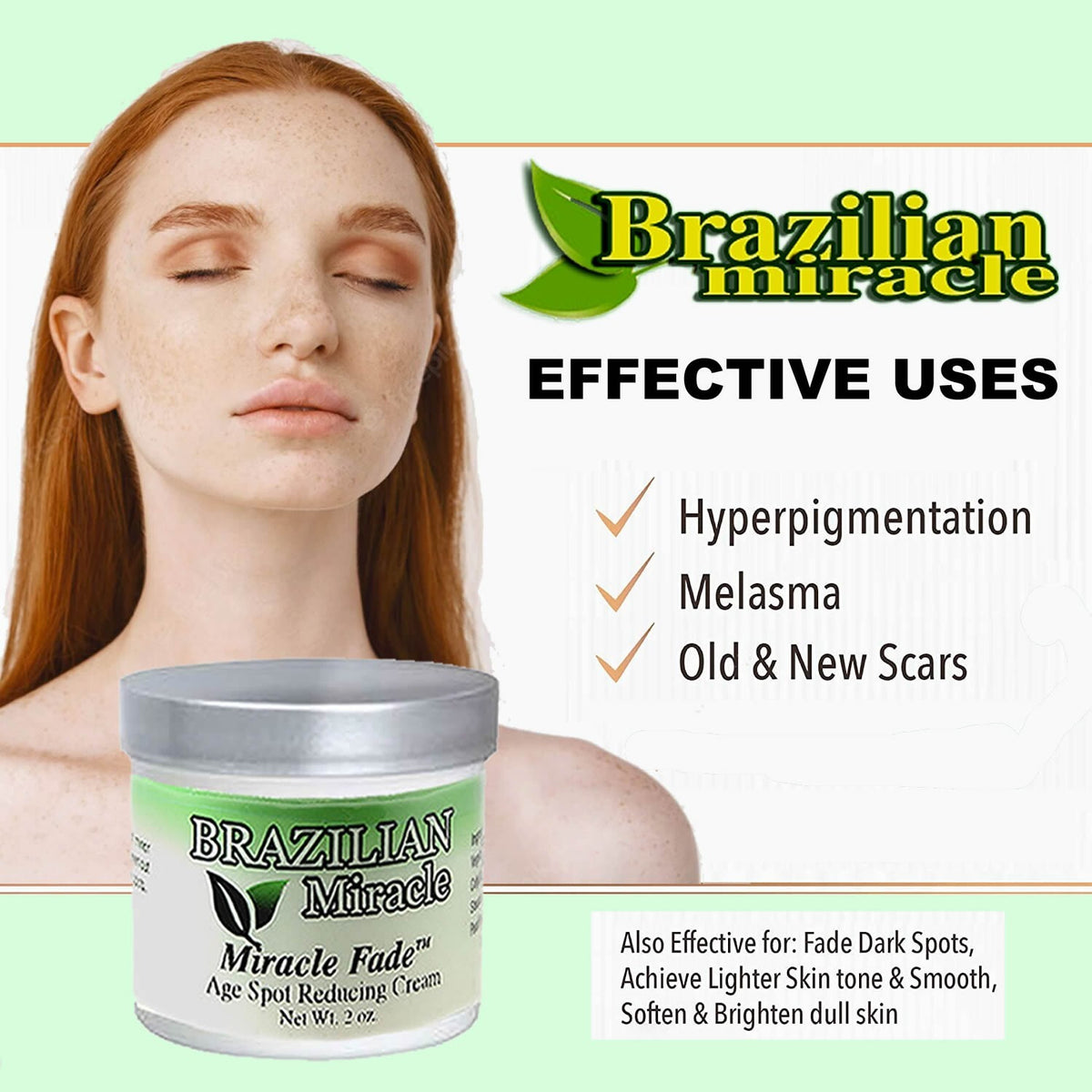 Natural Birthmark & Age Spot Lightening Cream - Botanical Formula, 1 Month Supply