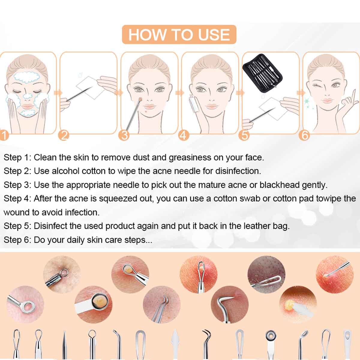 9 Pcs Blackhead and Acne Pimple Remover Tool Kit - Comedone Extractors & Spot Popper