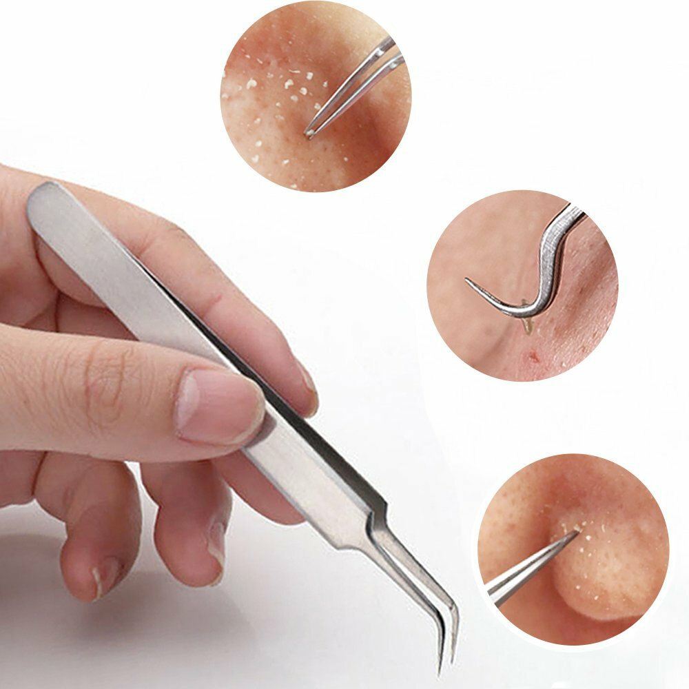 Blackhead Remover Tool Kit for Acne & Pimple Extraction - 9 Pcs