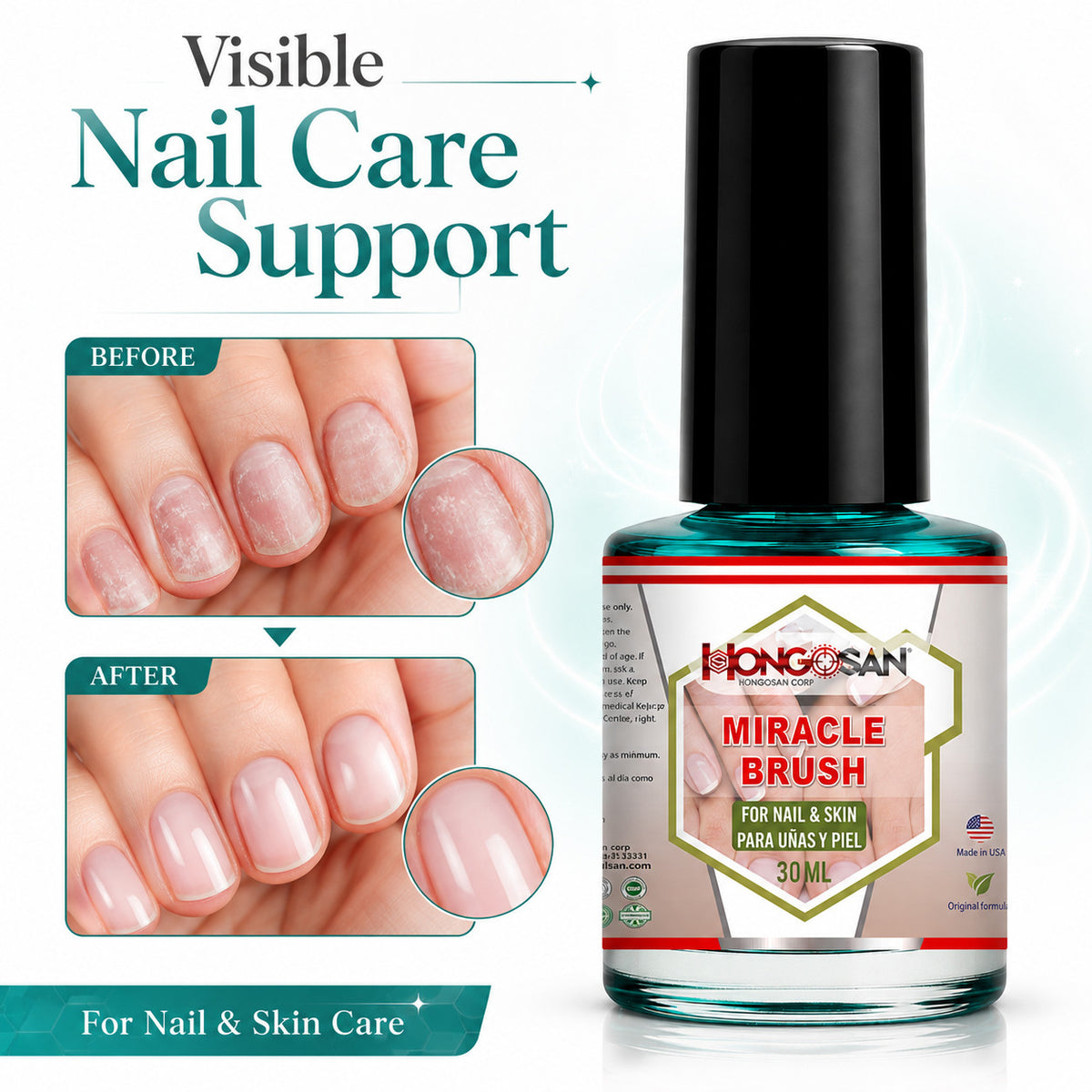Antifungal Toenail Support Liquid - Fast-Acting Nail Fungus Treatment 1 OZ