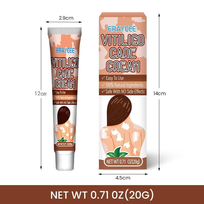 Vitiligo Cream Natural Skin Pigmentation Treatment for White Spots - Safe & Effective
