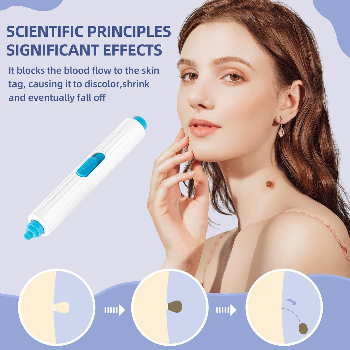 Painless Skin Tag Remover Kit Auto Safe Removal Device for 1-9mm Bands