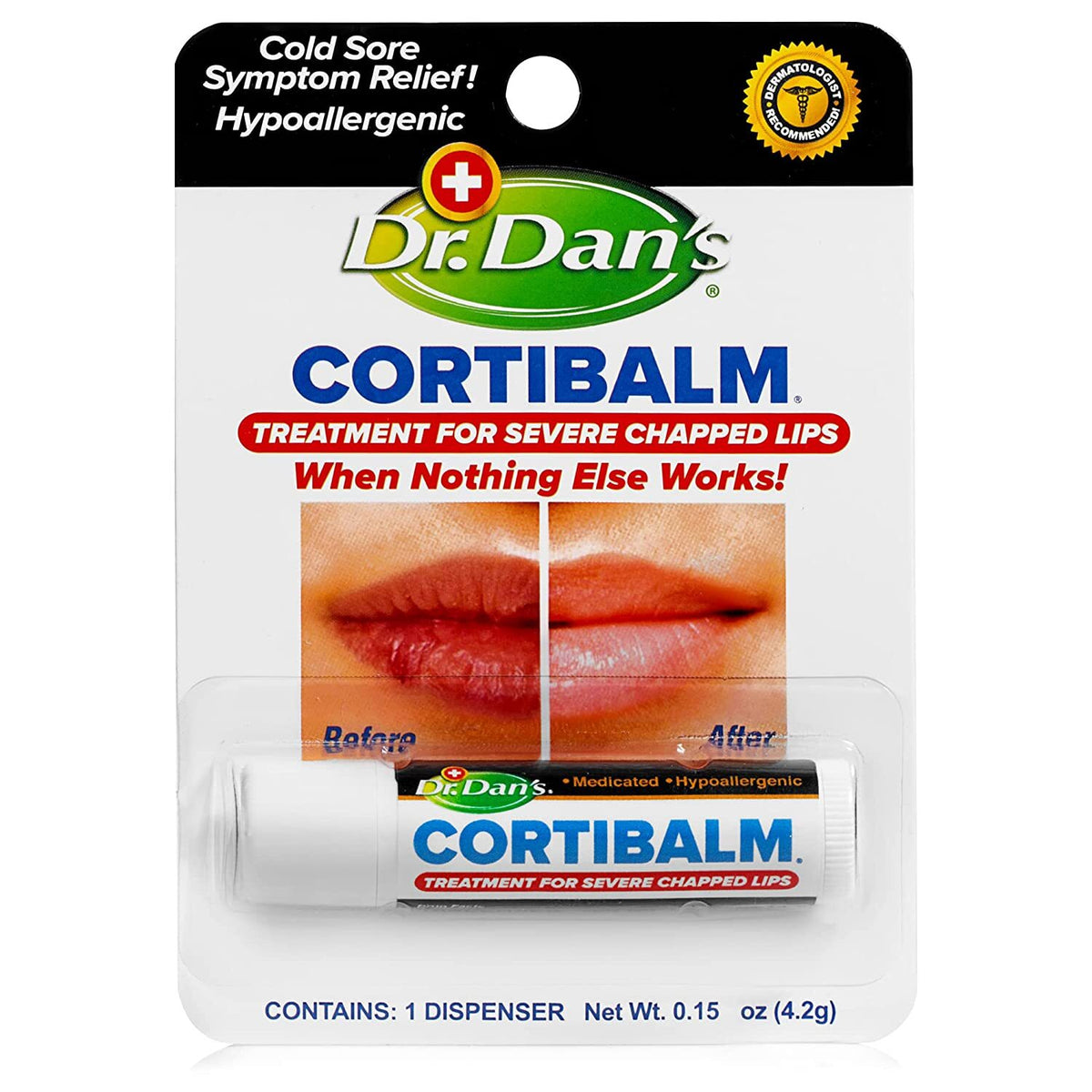 Medicated Lip Balm with Hydrocortisone 1% for Severe Chapped Lips 0.14 oz