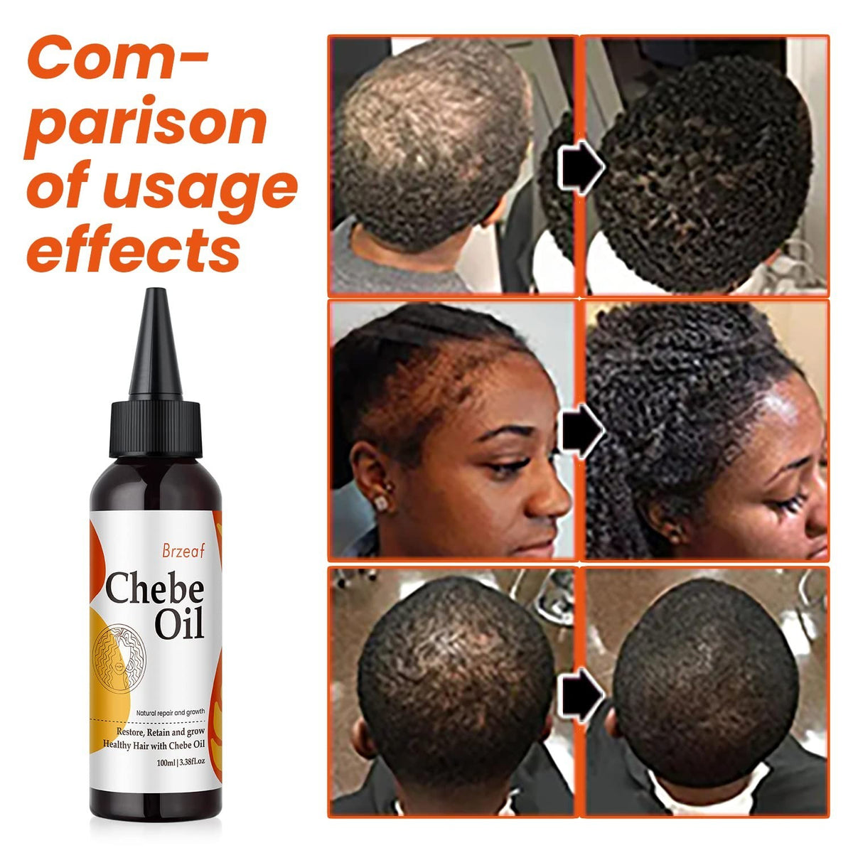 Natural Chebe Oil for Hair Growth & Moisture Restoration - 3.38Oz
