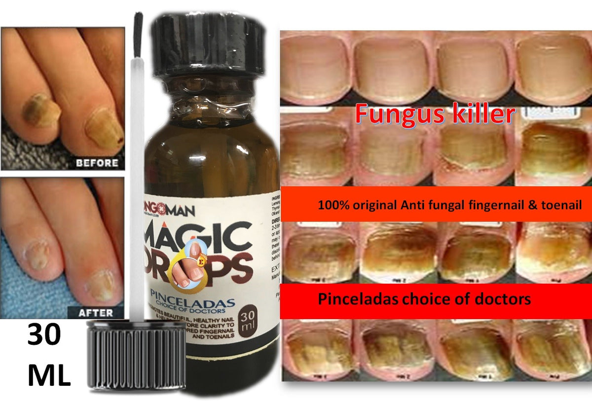 Nail Repair Treatment 2 Pack - Natural Essential Oil Formula, 30ml