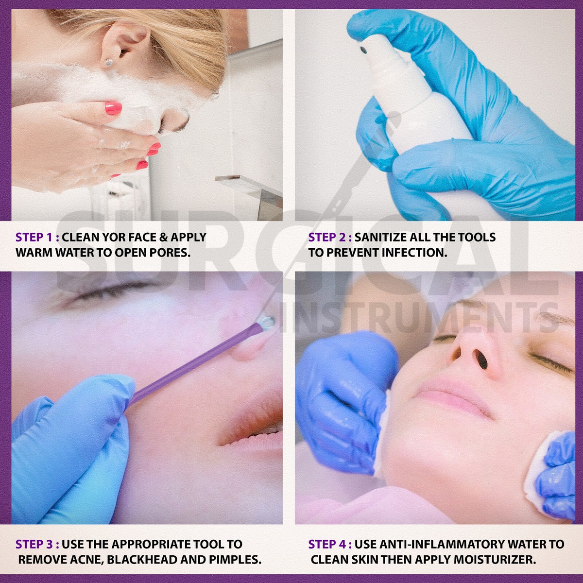 Pimple Popper Tool Kit - 10 Pcs Blackhead Remover & Comedone Extractor Set
