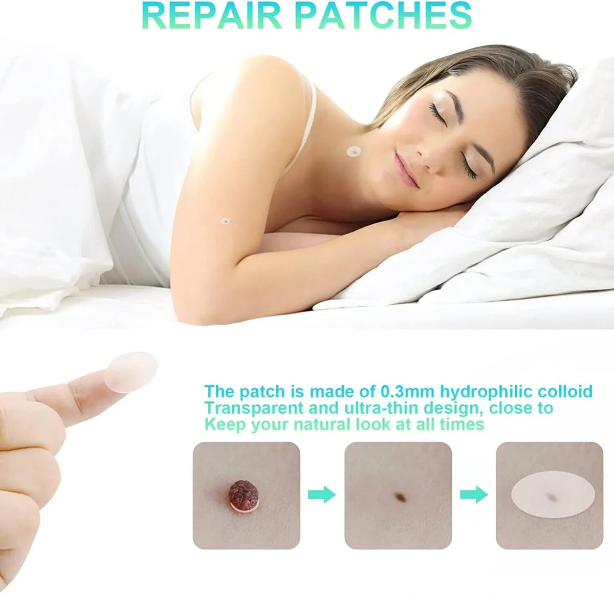 Painless Skin Tag Remover Kit for 1-8mm Moles Acne Wart Removal Set