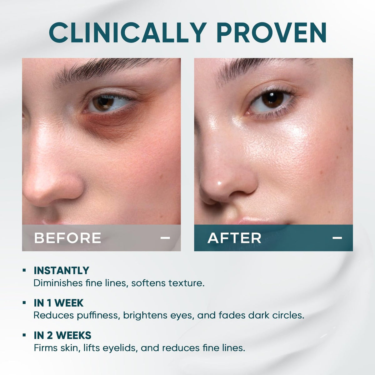 Elvira Dual Eye Cream for Dark Circles & Puffiness – 0.68 Ounce