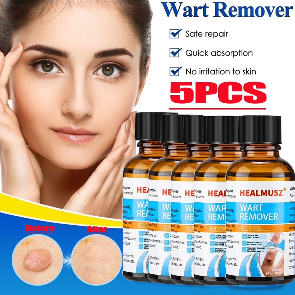 30ml Wart & Skin Tag Remover Liquid - Natural Herbal Formula for Foot & Body Warts