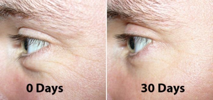 Peptide Face Serum with Argireline Hyaluronic Acid Matrixyl 3000 Anti-Aging Moisturizer