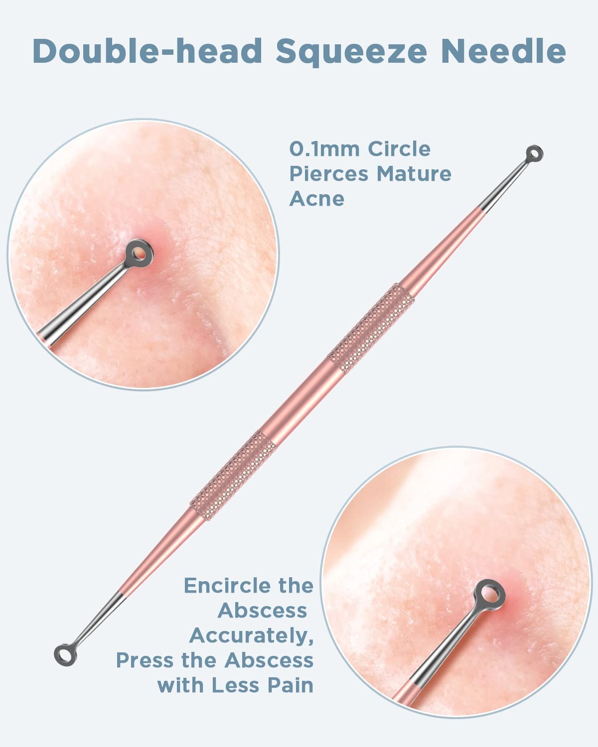 Blackhead Remover Tool Kit - Rose Gold 5-Piece Skin Care Set for Clear Complexion