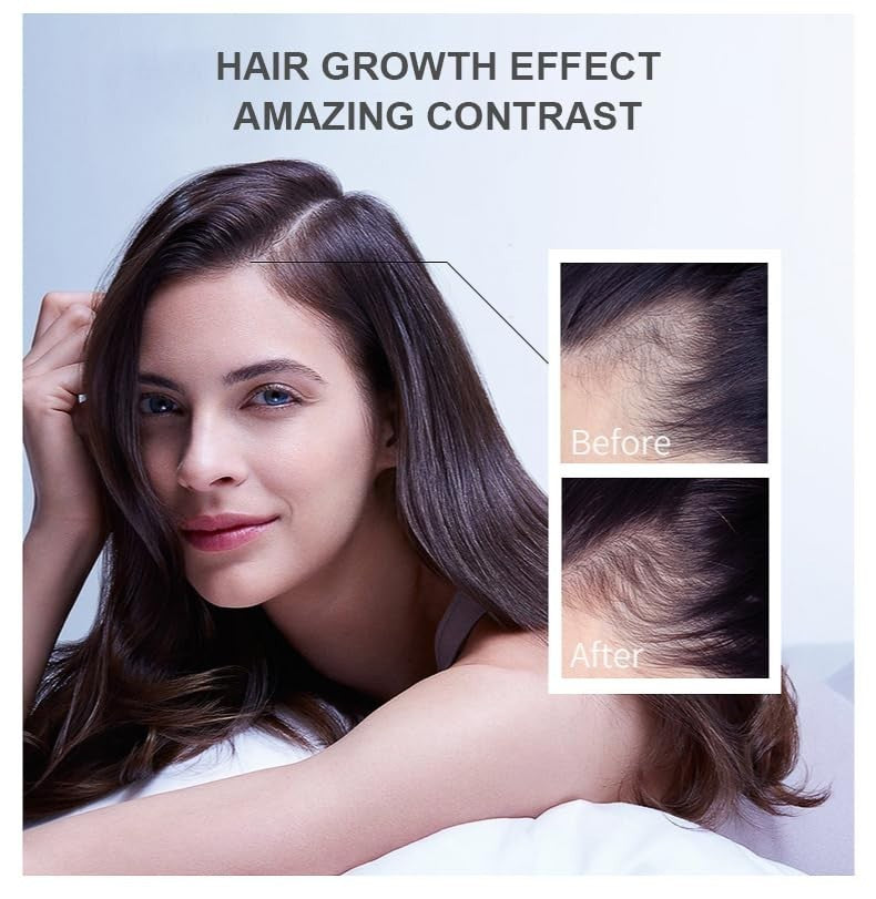 Ginger Hair Growth Oil Treatment - Anti Hair Loss Serum