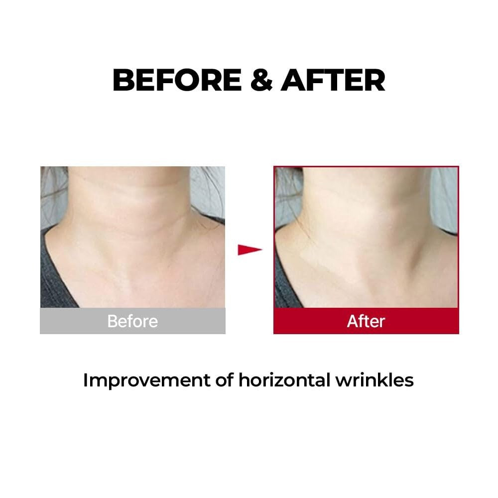 Collagen Neck Cream for Skin Elasticity - 100ml Anti-Aging Treatment