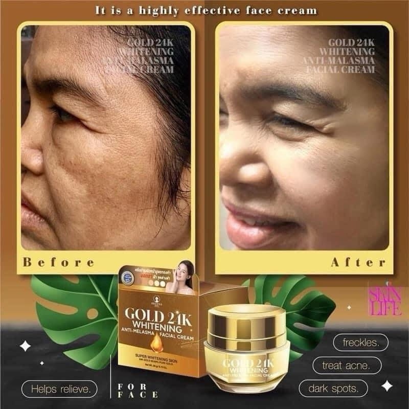 Gold 24K Whitening Facial Cream for Anti-Melasma Acne Freckles - 15g