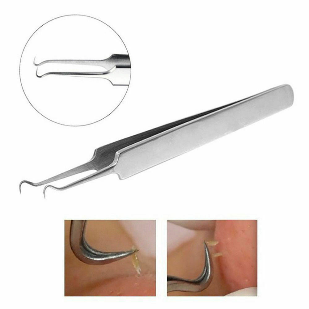 Blackhead Whitehead Pimple Popper Remover Tool for Acne Spot Extraction